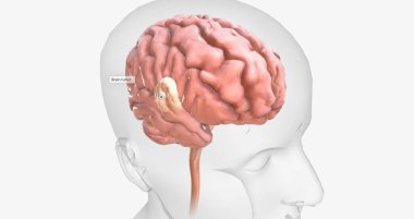 Brain tumors are abnormal growths found in brain tissue. Brain tumors may be benign or malignant. 3D rendering