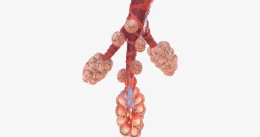 COVID-19, Acute Respiratory Distress Syndrome 3D rendering