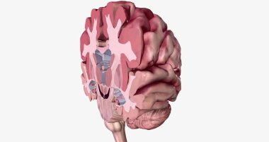 Alzheimer's Disease Brain Cross Section 3D rendering