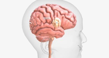 Brain tumors are abnormal growths found in brain tissue. Brain tumors may be benign or malignant. 3D rendering