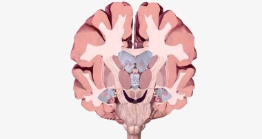 Alzheimer's Disease Brain Cross Section 3D rendering