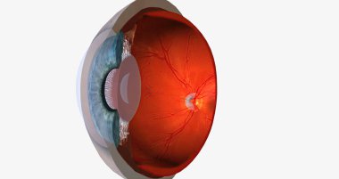 Higher than normal intraocular pressure in the absence of ocular hypertension, optic nerve damage, or visual field loss 3D rendering