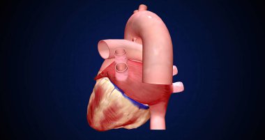 The erratic electrical signals cause the atria to quiver. 3D rendering