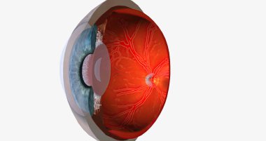 Higher than normal intraocular pressure in the absence of ocular hypertension, optic nerve damage, or visual field loss 3D rendering