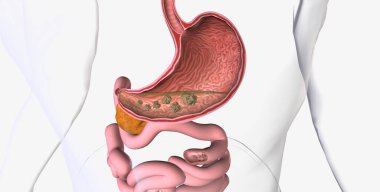 Glucose is the body primary source of fuel and is either converted into energy within cells 3D rendering