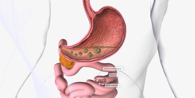 Glucose is the body primary source of fuel and is either converted into energy within cells 3D rendering