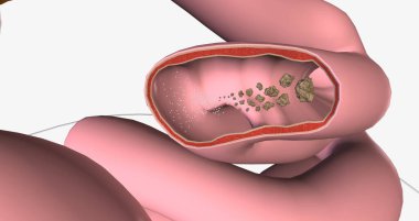 Glucose is the body primary source of fuel and is either converted into energy within cells 3D rendering