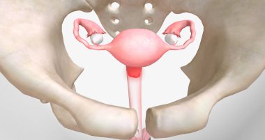 Chlamydia is a sexually transmitted infection caused by Chlamydia trachomatis bacteria.3D rendering