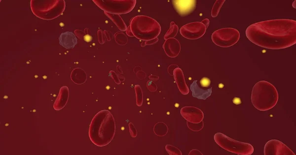 Hypercalcemia is a condition characterized by increased calcium levels in the blood. 3D rendering