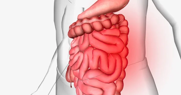 Abdominal pain is a common symptom that affects the digestive organs within the abdomen. 3D rendering