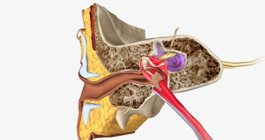 Labyrinthitis is an infection and inflammation of the inner ear and the nerves that connect the inner ear to the brain. 3D rendering
