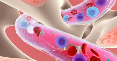 Lymphoblasts invaded and eventually replace healthy bone marrow, preventing the production of blood cells. 3D rendering