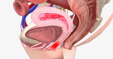 Menstruation is a normal, monthly process to shed the inner lining of the uterus. 3D rendering