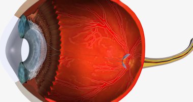 Higher than normal intraocular pressure in the absence of ocular hypertension, optic nerve damage, or visual field loss 3D rendering