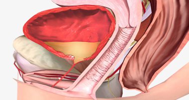 Weakened urethra and surrounding support structures allow urine to leak out of bladder 3D rendering