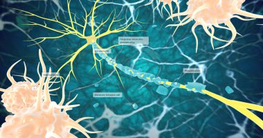 Remyelination is the phenomenon by which new myelin sheaths are generated around axons in the adult central nervous system 3D rendering