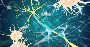 Remyelination is the phenomenon by which new myelin sheaths are generated around axons in the adult central nervous system 3D rendering