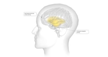 Anxiety is a neurological condition characterized by persistent, uncontrollable worry accompanied by emotional distress. 3D rendering