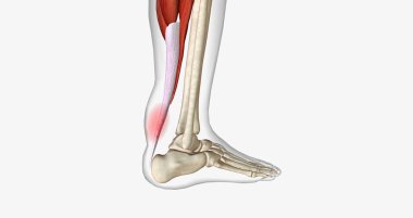 An ankle strain occurs when the muscles or tendons around the ankle are stretched too far. 3D rendering