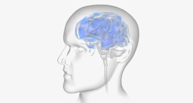 Epileptic seizure caused by abnormal electrical activity in brain 3D rendering