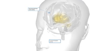 Anxiety is a neurological condition characterized by persistent, uncontrollable worry accompanied by emotional distress. 3D rendering