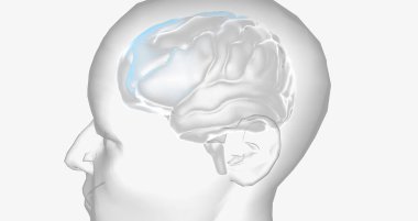 The Attention Deficit Hyperactivity Disorder 3D rendering