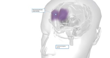 Anxiety is a neurological condition characterized by persistent, uncontrollable worry accompanied by emotional distress. 3D rendering