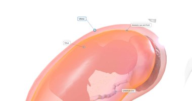 The Overview of Amniocentesis 3D rendering