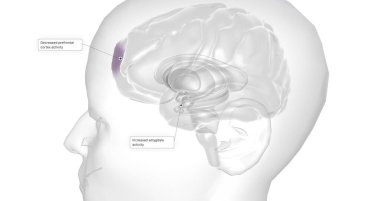 Anxiety is a neurological condition characterized by persistent, uncontrollable worry accompanied by emotional distress. 3D rendering