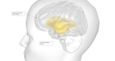 Anxiety is a neurological condition characterized by persistent, uncontrollable worry accompanied by emotional distress. 3D rendering