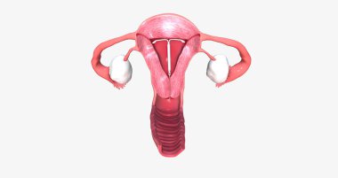 intra uterine device inside fantom uterus 3D rendering