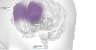 Anxiety is a neurological condition characterized by persistent, uncontrollable worry accompanied by emotional distress. 3D rendering