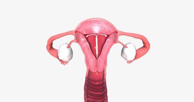 intra uterine device inside fantom uterus 3D rendering