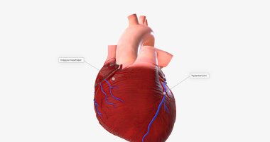 The Irregular Heartbeat and Hypertension 3D rendering