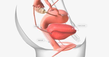 Gonorrhea is a sexually transmitted infection caused by the bacterium Neisseria gonorrhoeae 3D rendering