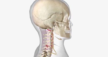 Burst fractures are traumatic injuries that result from excessive force on the spine. 3D rendering