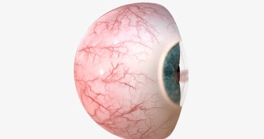 A corneal abrasion, or scratch, is a shallow injury to the surface of the cornea. 3D rendering