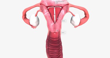 intra uterine device inside fantom uterus 3D rendering