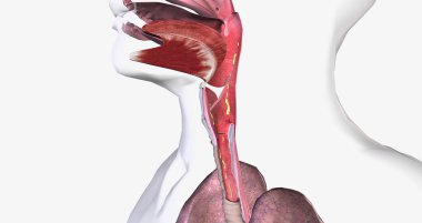 Croup is breathing difficulty and a barking cough. Croup is due to swelling around the vocal cords. 3D rendering