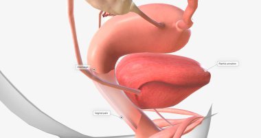 Gonorrhea is a sexually transmitted infection caused by the bacterium Neisseria gonorrhoeae 3D rendering