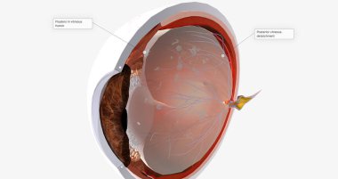 Floaters are small spots in your field of vision. 3D rendering