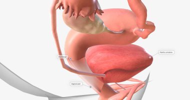 Gonorrhea is a sexually transmitted infection caused by the bacterium Neisseria gonorrhoeae 3D rendering