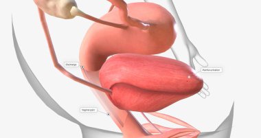 Gonorrhea is a sexually transmitted infection caused by the bacterium Neisseria gonorrhoeae 3D rendering
