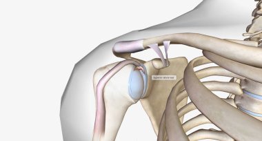 A superior labral tear is when a lesion is found in the upper portion for the labrum.3D rendering clipart