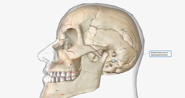 Swollen facial nerve in stylomastoid foramen 3D rendering