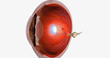 Hyperopia is a common visual condition in which the eye's ability to focus on nearby objects is impaired.3D rendering