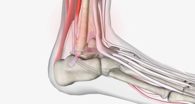 Ankle sprains are classified based on the amount of damage to the ligament.3D rendering