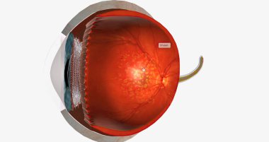 Dry macular degeneration is a type of age-related vision impairment that results in blurred or lost central vision.3D rendering