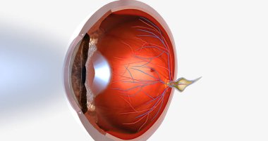 Hyperopia is a common visual condition in which the eye's ability to focus on nearby objects is impaired.3D rendering