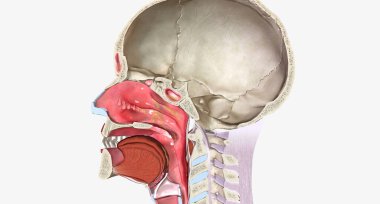 Nasal polyps are benign, soft growths that arise from the mucosa of the nasal passages or sinuses.Damaged optic nerve leads to disrupted signaling to brain 3D rendering